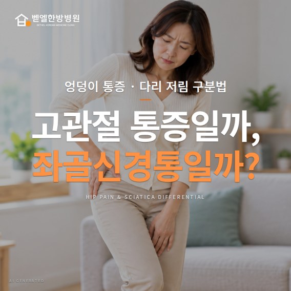고관절 통증일까, 좌골신경통일까? 엉덩이 통증·다리 저림 구분법 표지