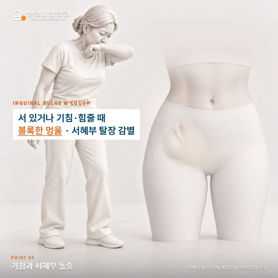 기침과 서혜부 돌출: 서 있거나 기침·힘줄 때 볼록한 멍울 · 서혜부 탈장 감별