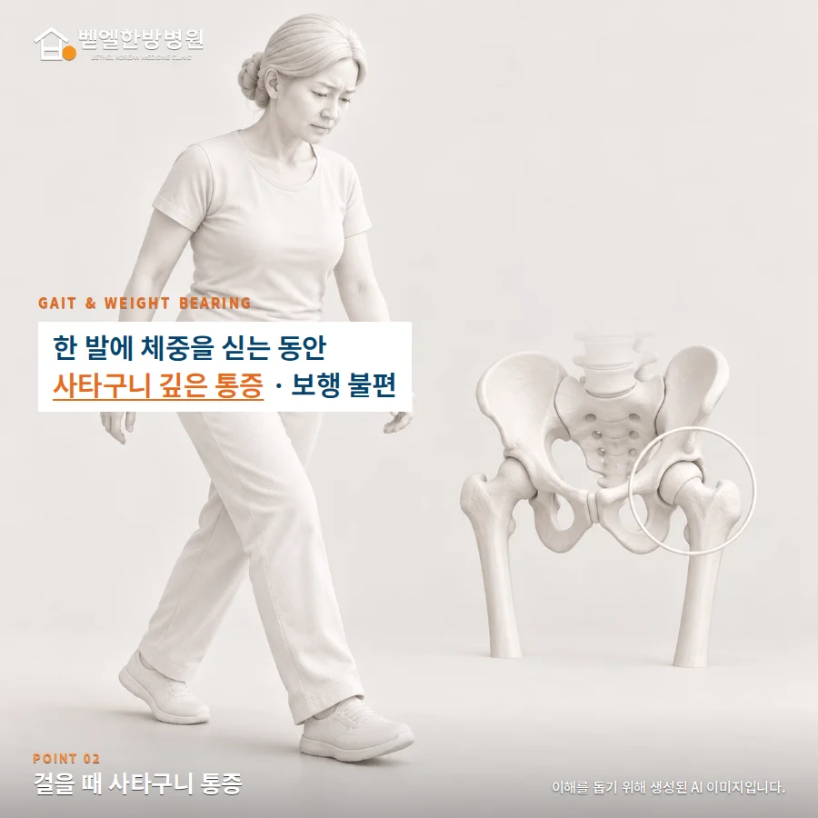 걸을 때 사타구니 통증: 한 발에 체중을 싣는 동안 사타구니 깊은 통증 · 보행 불편