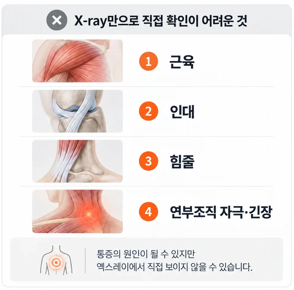엑스레이만으로 직접 확인이 어려운 것 네 가지 — 근육, 인대, 힘줄, 연부조직 자극·긴장을 해부 그림과 함께 정리한 표