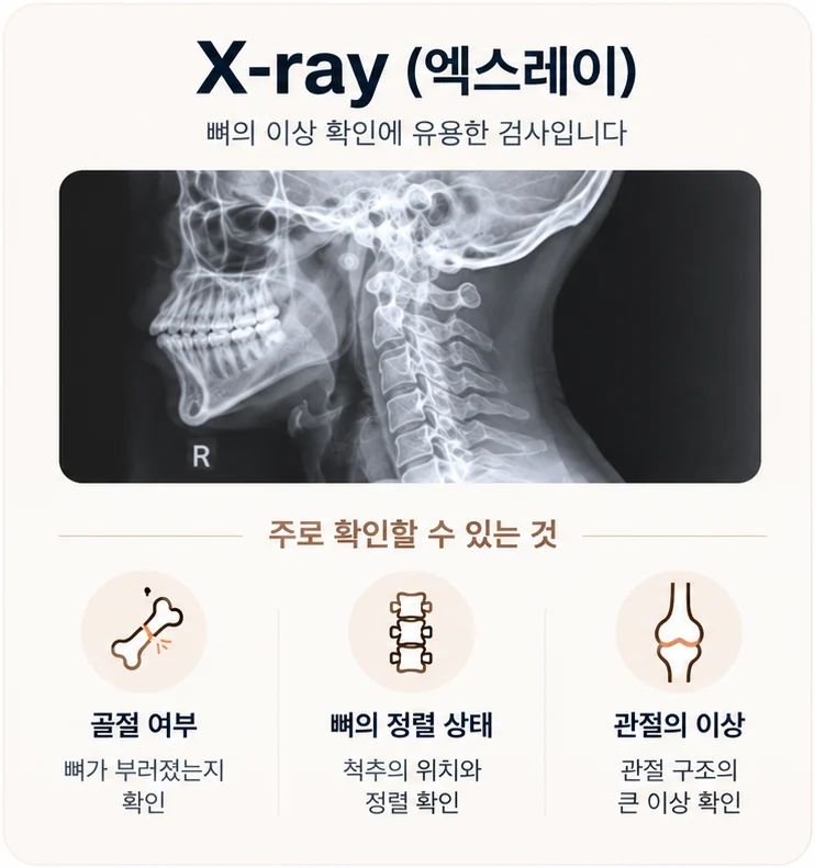 엑스레이는 뼈의 이상 확인에 유용한 검사 — 골절 여부, 뼈의 정렬 상태, 관절의 이상을 주로 확인한다